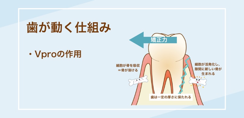 マウスピース矯正を短期間で終わらせたい！矯正加速装置で治療