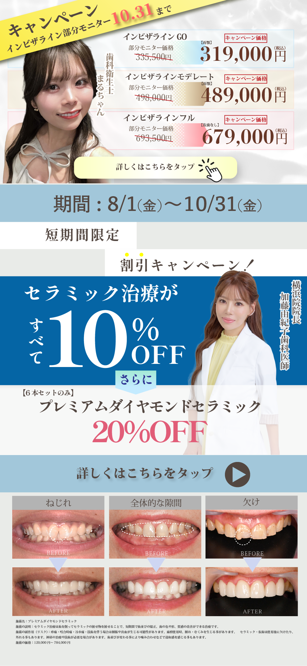 【4月】歯科月替わりキャンペーン　高品質のセラミック(被せ物)が低価格で登場！症例数の多い湘南歯科クリニックだから実現できるクオリティ