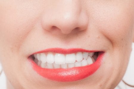 歯の隙間の詰め物が臭いのはなぜなの？