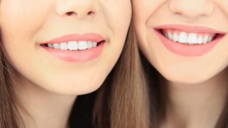 受け口で顎が長い場合は矯正で治る？