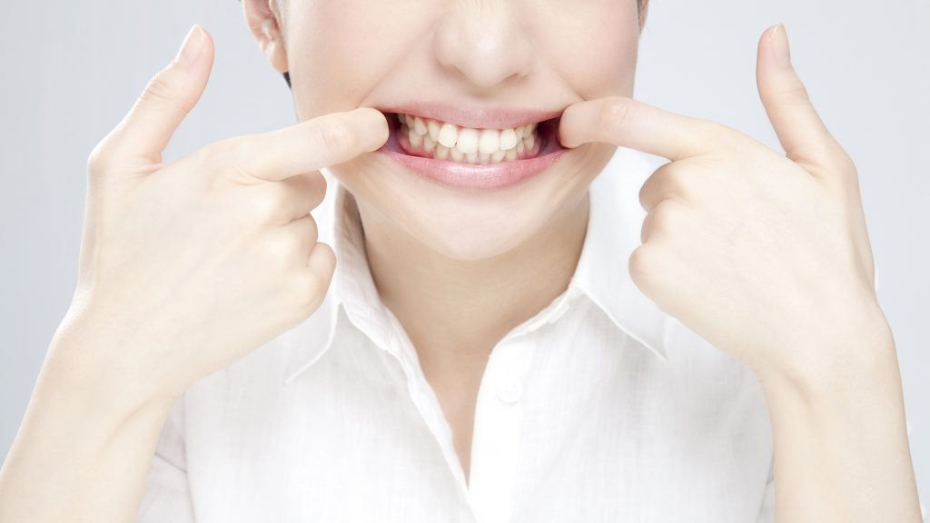 歯科矯正の器具で口の中が切れることってあるの？