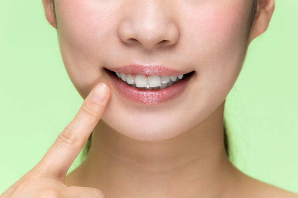 歯が短いとガミースマイルになりやすいの？