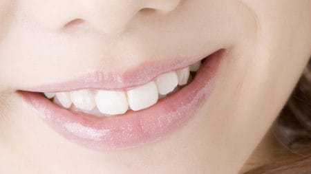 歯と歯の隙間に茶渋がつきやすいのはなぜ？