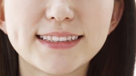 歯と歯の間に隙間ができる原因とは？