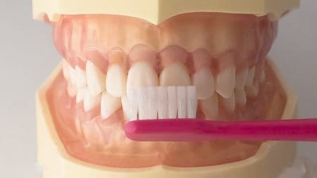 仮歯を作る時間はどのくらい？