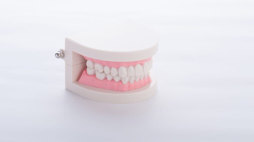 銀歯だらけの歯をきれいに見せる方法とは？