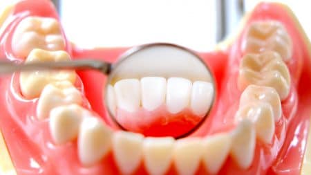 歯の黄ばみはイチゴで対策できますか？