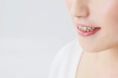 噛み合わせが悪い（不正咬合）と起きる悪影響｜歯科で矯正治療がおすすめ