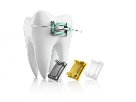 部分矯正できない歯の例3つ｜前歯や八重歯だけと思っていても全体矯正になる人が多い