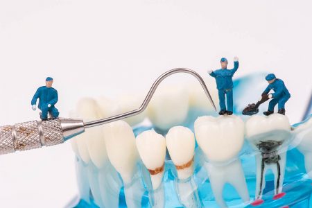【専門医が解説】歯の詰め物（インレー）の素材の種類｜金属・レジン・セラミックのメリットとデメリット | ハコラム