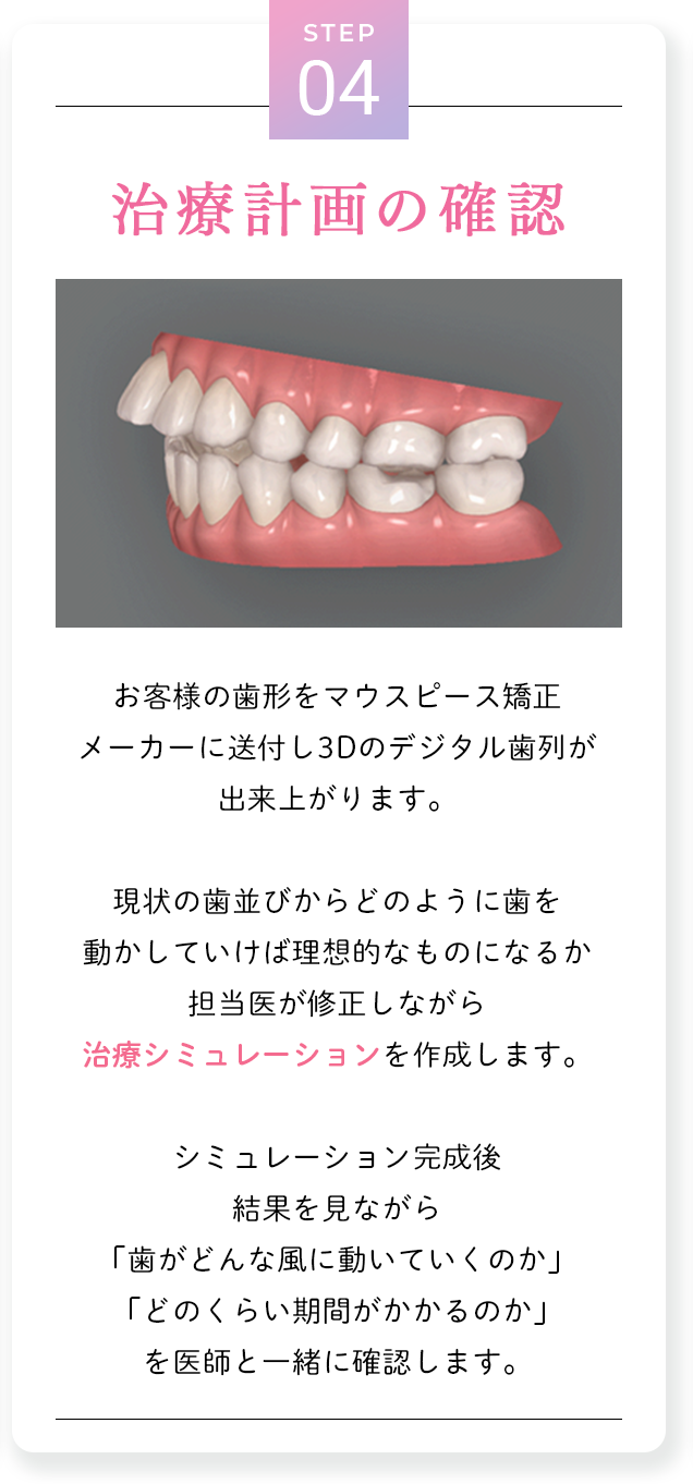 step4
